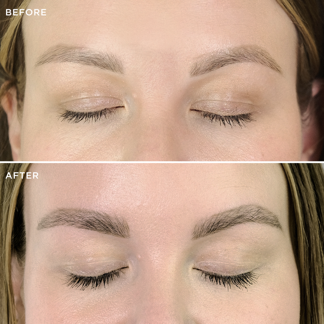 Before and after comparison 6